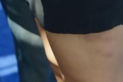 Oops! Το κοντό φόρεμα αποκάλυψε τις μελανιές της διάσημης star!