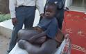 VIDEO | Ανήλικος πάσχει από ελεφαντίαση - Φωτογραφία 1