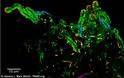 Τα βακτήρια που «φιλοξενεί» το ανθρώπινο στόμα - Φωτογραφία 3