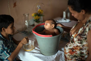 Η μεγάλη ανακάλυψη για τον ιο Ζίκα: Χτυπάει στον εγκέφαλο των μωρών... - Φωτογραφία 1