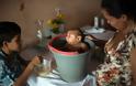 Η μεγάλη ανακάλυψη για τον ιο Ζίκα: Χτυπάει στον εγκέφαλο των μωρών...