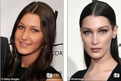 Βρείτε τις διαφορές: Τι έχει κάνει η Bella Hadid στο πρόσωπο της; [photos]