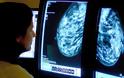 Συνδυασμός φαρμάκων «εξαφανίζει» ακόμα και εντελώς τους όγκους του καρκίνου του στήθους