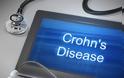 Νόσος Crohn και κολίτιδα: Νέα δεδομένα από αποτελεσματική θεραπεία