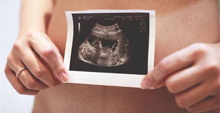 Εκτυπωμένη ωοθήκη υπόσχεται αποκατάσταση της γονιμότητας - Φωτογραφία 1