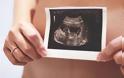 Εκτυπωμένη ωοθήκη υπόσχεται αποκατάσταση της γονιμότητας
