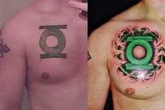 Για όσους μετάνιωσαν το tattoo τους