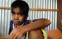 ΣΟΚΑΡΙΣΤΙΚΟ: Ο 13χρονος λυκάνθρωπος που λατρεύεται σαν Θεός - Αρνείται οποιαδήποτε θεραπεία γιατί θεωρεί τον εαυτό του... [photos] - Φωτογραφία 2