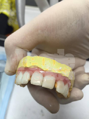 YFSF: Πώς κατάφεραν να «χαλάσουν» τα δόντια του Βαλάντη; [photos] - Φωτογραφία 3