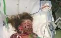 Η συγκλονιστική ιστορία της 2χρονης που πέθανε από Μηνιγγίτιδα [photos] - Φωτογραφία 2