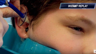 Βίντεο - σοκ: Δείτε τι έβγαλε ο γιατρός από το αφτί αυτού του παιδιού [video] - Φωτογραφία 1