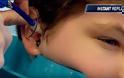 Βίντεο - σοκ: Δείτε τι έβγαλε ο γιατρός από το αφτί αυτού του παιδιού [video]