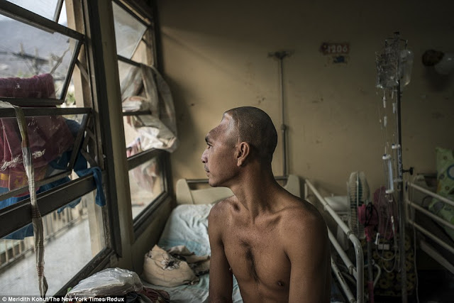 Σοκαριστικές εικόνες από το νοσοκομείο στη Βενεζουέλα: Παιδιά πεθαίνουν και οι γιατροί δεν έχουν εργαλεία [photos] - Φωτογραφία 3