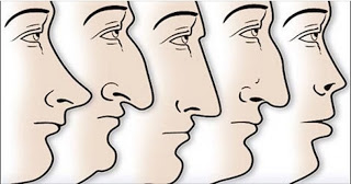 Συγκεκριμένα γονίδια διαμορφώνουν το σχήμα της μύτης! - Φωτογραφία 1