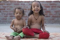 Οι γονείς που βλέπουν τα παιδιά τους να γερνούν γρηγορότερα κι από τους ίδιους