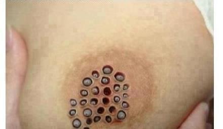 ΣΟΚ! Πονούσε επίμονα στο στήθος και μετά αυτό που είδε την άφησε ΑΝΑΥΔΗ! [photos] - Φωτογραφία 3