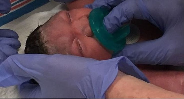 Μωρό με μικροκεφαλία λόγω του ιού Ζίκα γεννήθηκε στο Νιου Τζέρσι - Φωτογραφία 1
