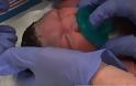 Μωρό με μικροκεφαλία λόγω του ιού Ζίκα γεννήθηκε στο Νιου Τζέρσι - Φωτογραφία 1
