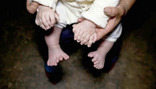 Μωρό γεννήθηκε με 31 δάχτυλα [photos] - Φωτογραφία 1