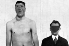 Ξεκίνησε τη ζωή του ως νάνος και πέθανε ως γίγαντας! [photos]