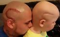 Συγκινητικό: Αυτός ο πατέρας έκανε tattoo το σημάδι του γιου του που έπασχε από καρκίνο στον εγκέφαλο