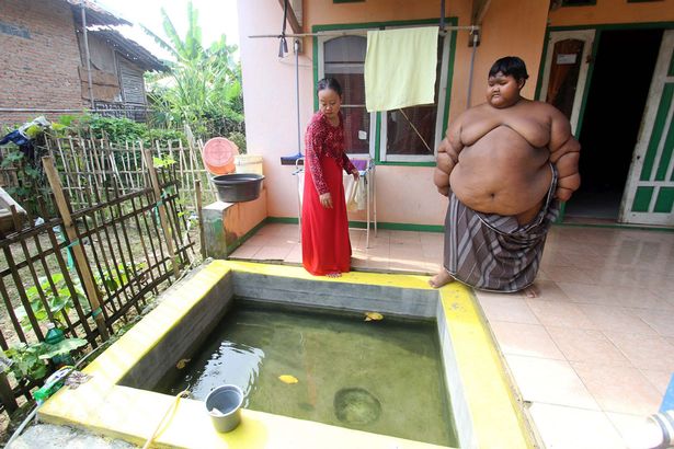 ΣΟΚΑΡΙΣΤΙΚΟ - Το πιο χοντρό παιδί του κόσμου – Στα 10 του ζυγίζει 192 κιλά [photos] - Φωτογραφία 3