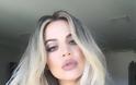 Η selfie της Khloe Kardashian που δείχνει τη νέα της πλαστική... [photo] - Φωτογραφία 2