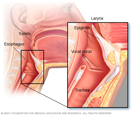 Καρκίνος στο λαιμό: Τα κυριότερα συμπτώματα - Φωτογραφία 2