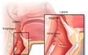 Καρκίνος στο λαιμό: Τα κυριότερα συμπτώματα - Φωτογραφία 2