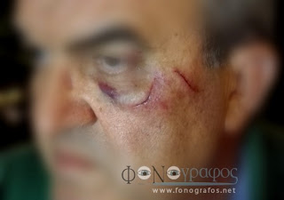 Σπερχειάδα: Πλακώθηκαν στο ξύλο πρώην Αυτοδιοικητικός με αστυνομικό! [photo] - Φωτογραφία 1