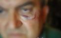 Σπερχειάδα: Πλακώθηκαν στο ξύλο πρώην Αυτοδιοικητικός με αστυνομικό! [photo] - Φωτογραφία 2