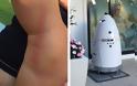 Mητέρα κατηγορεί ρομπότ ότι «επιτέθηκε» στο 16 μηνών αγοράκι της! - Φωτογραφία 1