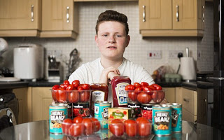 Έφηβος εθισμένος στη ντομάτα υπνωτίστηκε για να φάει άλλο φαγητό! - Φωτογραφία 1