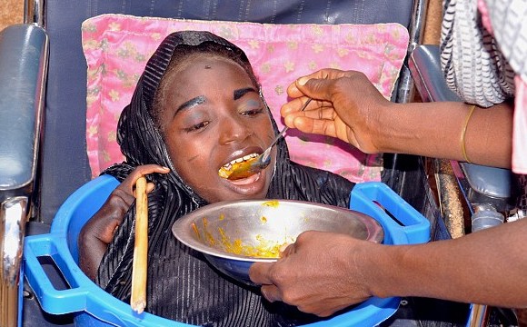 Νιγηρία: ΔΕΙΤΕ την 19χρονη που ζει σε μία πλαστική ΛΕΚΑΝΗ  - Πάσχει από ΑΓΝΩΣΤΗ ασθένεια - ΣΟΚΑΡΙΣΤΙΚΟ [photos+video] - Φωτογραφία 6