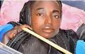 Νιγηρία: ΔΕΙΤΕ την 19χρονη που ζει σε μία πλαστική ΛΕΚΑΝΗ  - Πάσχει από ΑΓΝΩΣΤΗ ασθένεια - ΣΟΚΑΡΙΣΤΙΚΟ [photos+video]
