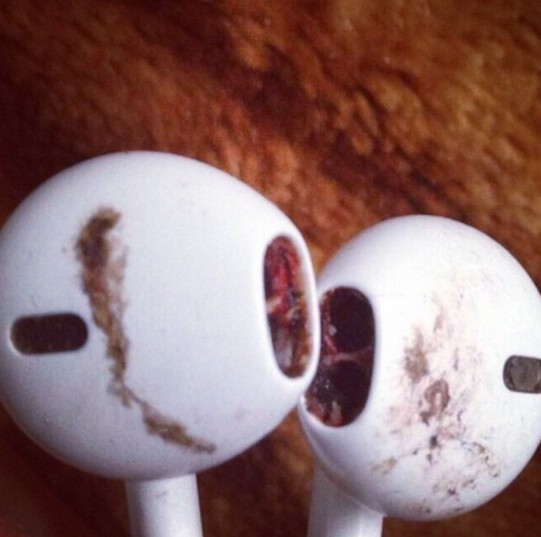 Να γιατί δεν πρέπει να δανείζετε τα ακουστικά σας [photos] - Φωτογραφία 3
