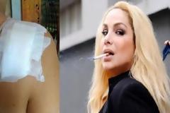 ΣΟΚ - Μάχη με τον καρκίνο για την Τζένη Χειλουδάκη: Πονεί ωρέ η Χειλουδάκενα που κάνει τον πόνο τσιχλόφουσκα;