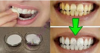 Επιβεβαιωμένο - Λευκάνετε τα κίτρινα δόντια σας σε λιγότερο από 2 λεπτά... [video] - Φωτογραφία 1