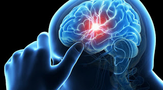 Προσοχή: Αυτά είναι τα σημάδια του εγκεφαλικού - Ποιοι διατρέχουν μεγάλο κίνδυνο; - Φωτογραφία 1