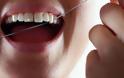 Υπερεκτιμημένος ο ρόλος του οδοντικού νήματος - Δεν μειώνει την οδοντική πλάκα