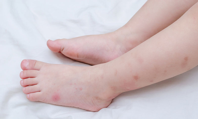 Πώς θα επιλέξετε το κατάλληλο απωθητικό κουνουπιών για το παιδί σας - Φωτογραφία 1