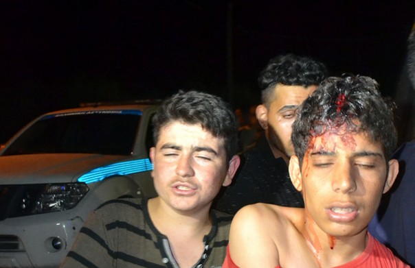 Άγριες συμπλοκές στο hot spot της Μόριας - Τραυματίστηκαν παιδιά [photos] - Φωτογραφία 1