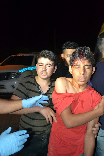 Άγριες συμπλοκές στο hot spot της Μόριας - Τραυματίστηκαν παιδιά [photos] - Φωτογραφία 2