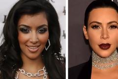 12 celebrities που έγιναν άλλοι άνθρωποι με πλαστικές επεμβάσεις