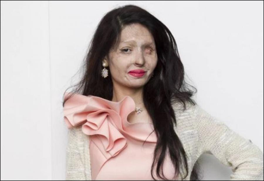 “Βασίλισσα” της πασαρέλας, η Ινδή που παραμορφώθηκε έπειτα από επίθεση με οξύ! - Φωτογραφία 1
