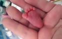Δείτε το πιο μικροσκοπικό μωρό στον κόσμο... [photos]