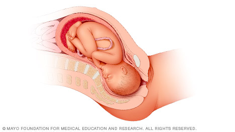 Αυτές είναι οι στάσεις του μωρού μέσα στην μήτρα πριν τον τοκετό! - Φωτογραφία 2
