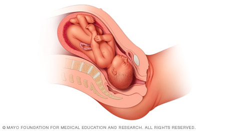 Αυτές είναι οι στάσεις του μωρού μέσα στην μήτρα πριν τον τοκετό! - Φωτογραφία 3
