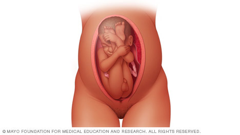 Αυτές είναι οι στάσεις του μωρού μέσα στην μήτρα πριν τον τοκετό! - Φωτογραφία 4