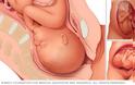Αυτές είναι οι στάσεις του μωρού μέσα στην μήτρα πριν τον τοκετό!